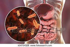 اعراض بكتيريا الامعاء , نصائح المحافظة على الامعاء
