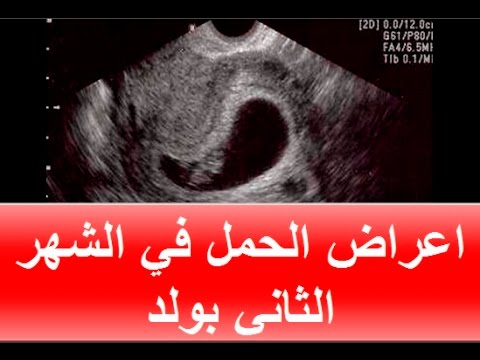 اعراض الحمل بولد , الحمل بالولد و اعراضه