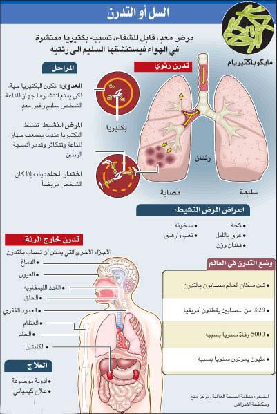 علاج مرض السل - طرق علاج مرض السل 2601 3