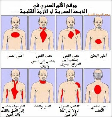 علاج مرض القلب - مرض القلب واهم طرق العلاج 2689 11