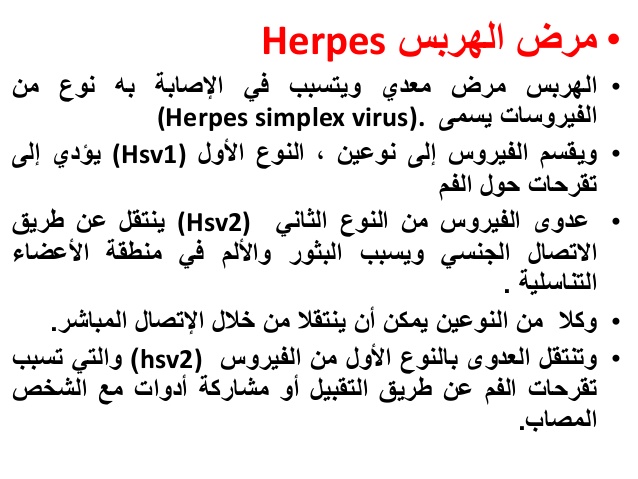 مرض الهربس - اهم ما يجب ان تعرفه عن مرض الهربس 2418 2