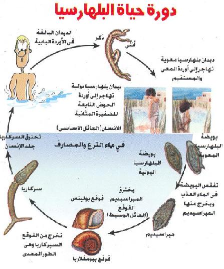 مرض البلهارسيا - ما هو مرض البلهاريسيا 5603 2