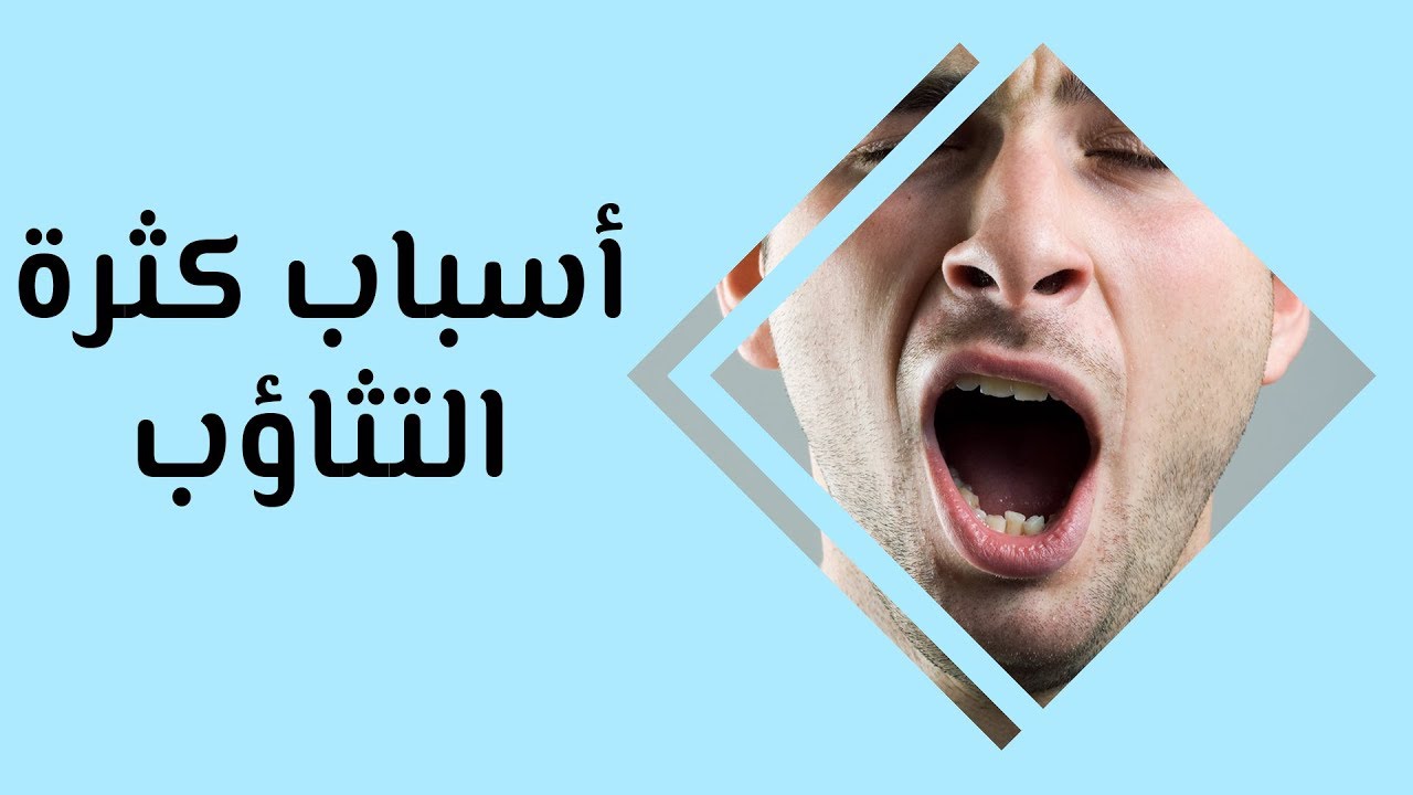 هل التثاؤب الكثير مرض - اسباب كثرة التثاؤب 10574 3