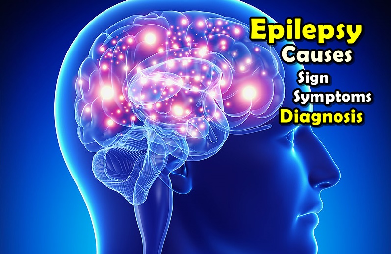 مرض الصرع , بعض المعلومات عن مرض الصرع