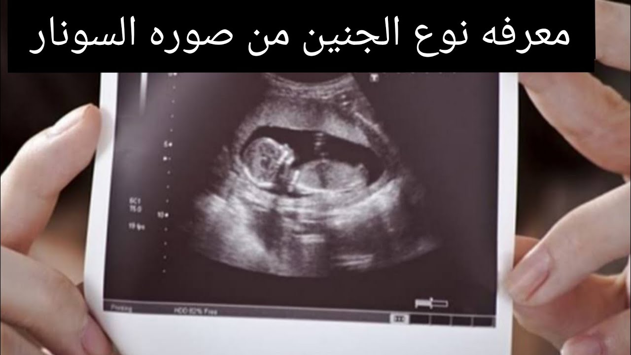 شكل الجنين في الشهر الرابع 10511 2