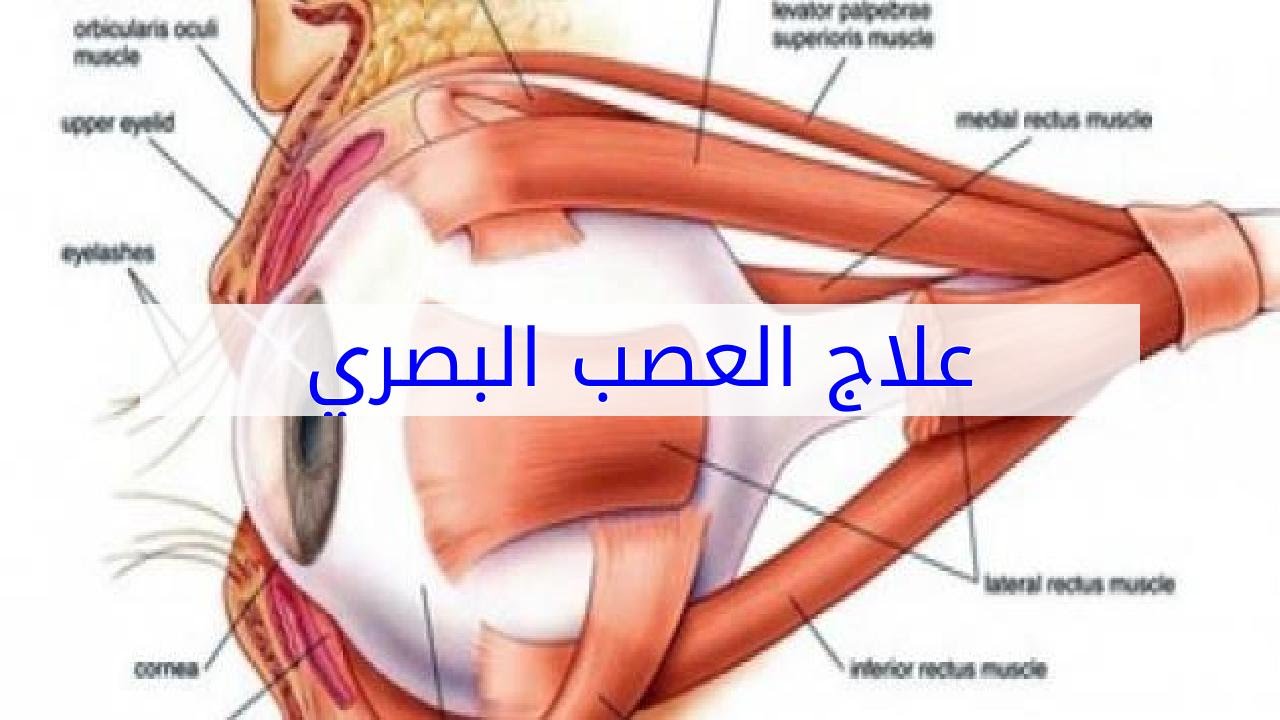 اعراض عصب العين 10362 2