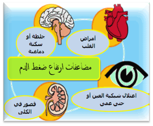 مرض الضغط - ما هو مرض الضغط 5361