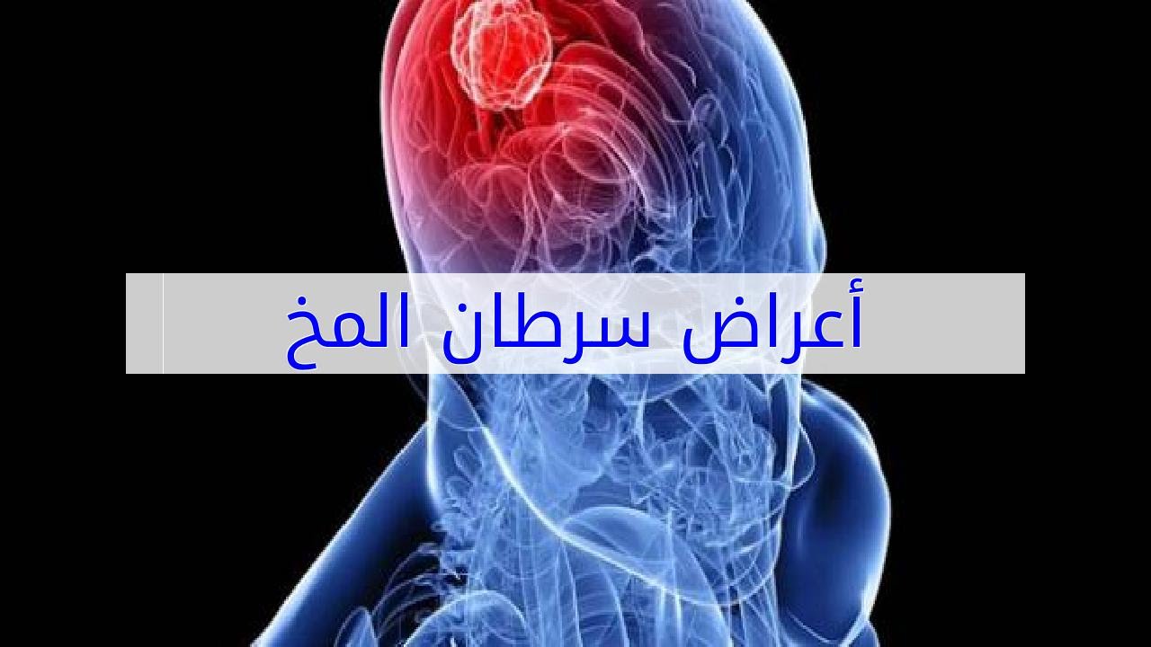 اعراض سرطان الدماغ 3585 1