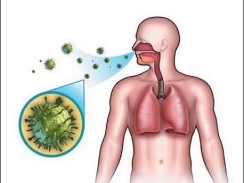 علاج مرض السل - طرق علاج مرض السل 2601 1