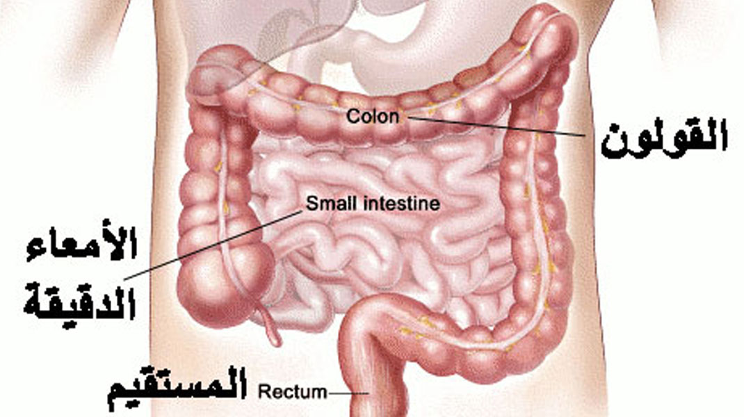 اعراض سرطان القولون - مرض سرطان القولون واعراضه 2222 1