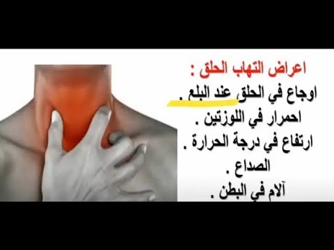 علاج التهاب الحلق - افضل طرق علاج التهاب الحلق 2390 2